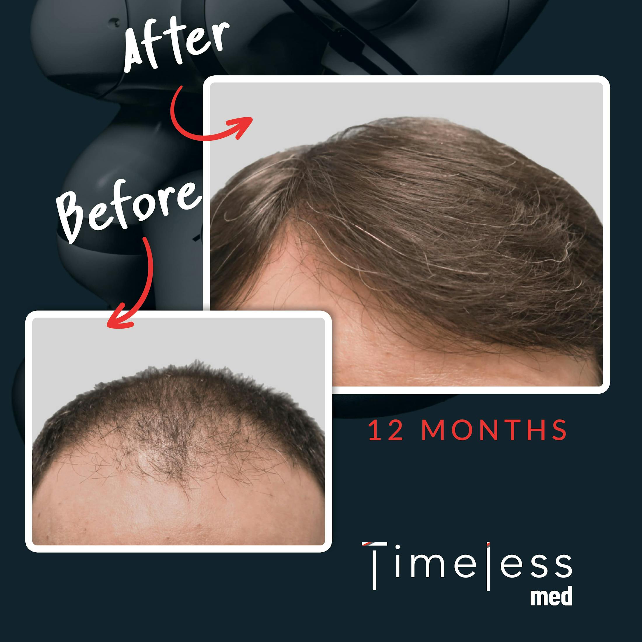 Hair Before & After Gallery - Patient 36412335 - Image 1