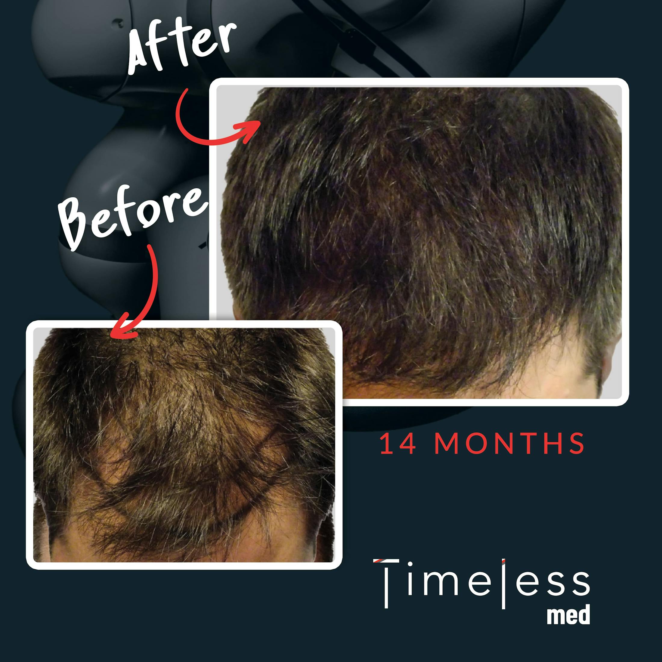 Hair Before & After Gallery - Patient 36412338 - Image 1