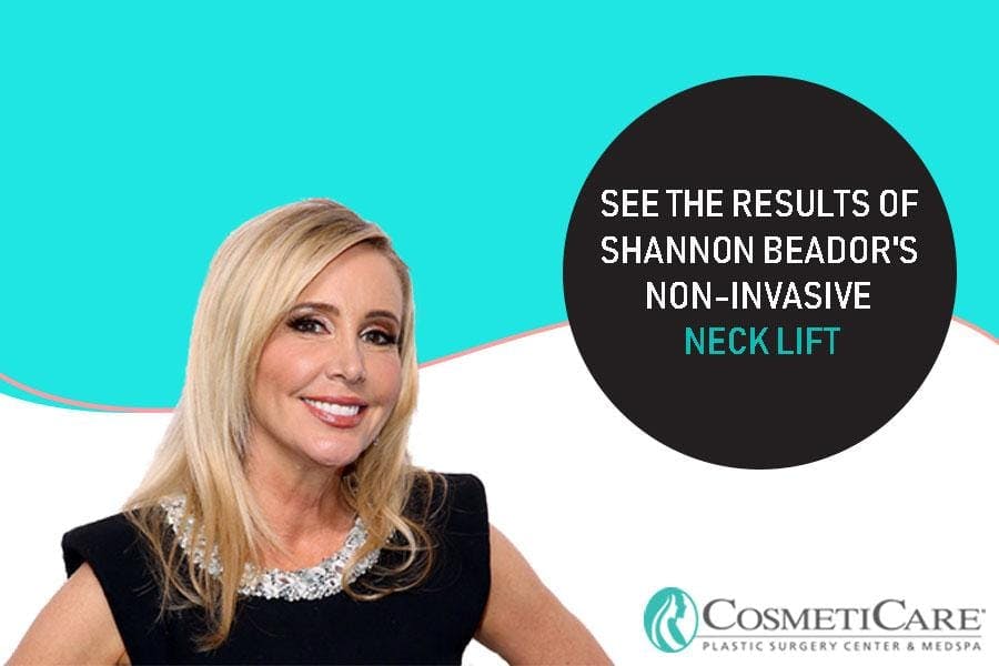 See the Results of Shannon Beador’s Non-Invasive Neck Lift