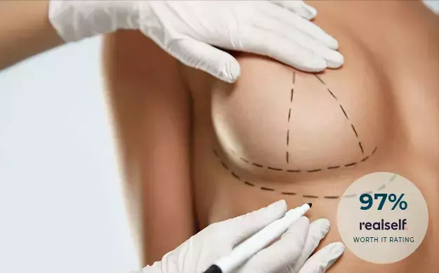 Woman's Breast with Incision Marks