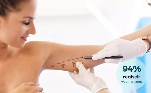 Woman Extending her Arm with Incision Marks
