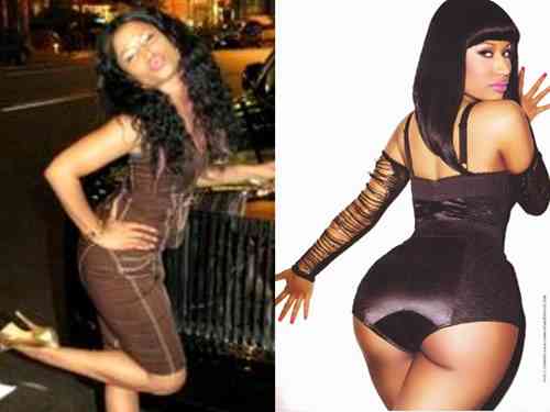 nicki minaj butt implants butt injections butt lift 