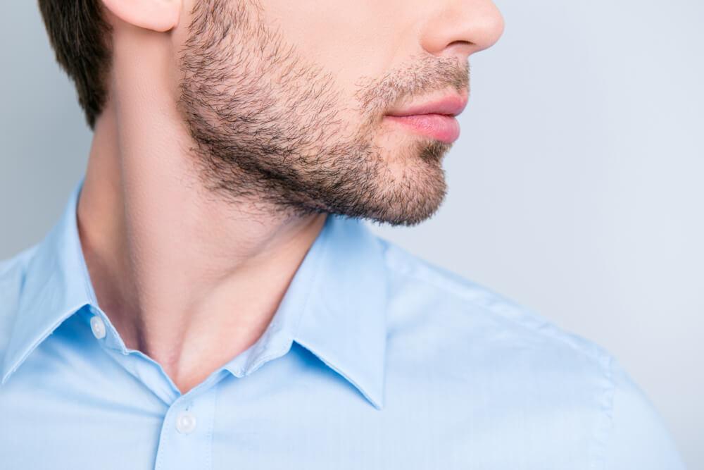 Men's Double Chin Kybella 