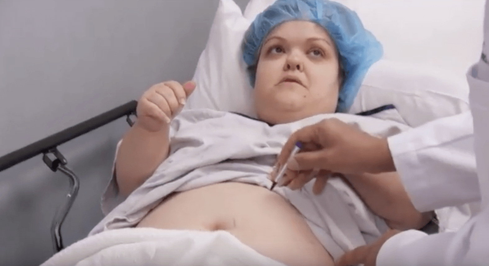 Christy Gibel Weight Loss Surgery