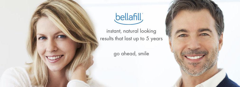 Orange County Bellafill for Smile Lines