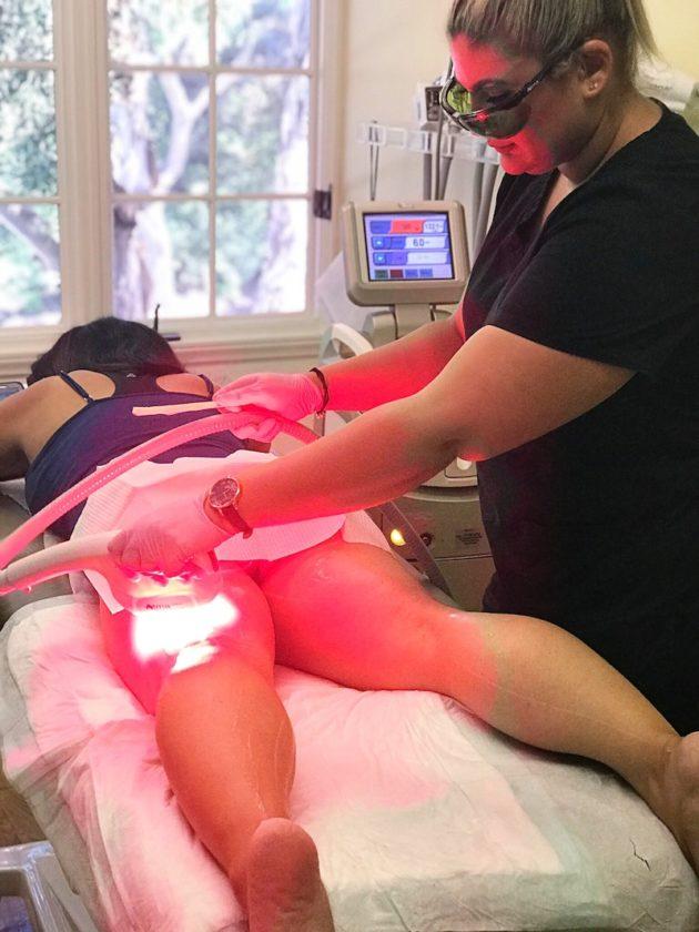 Laser Hair Removal