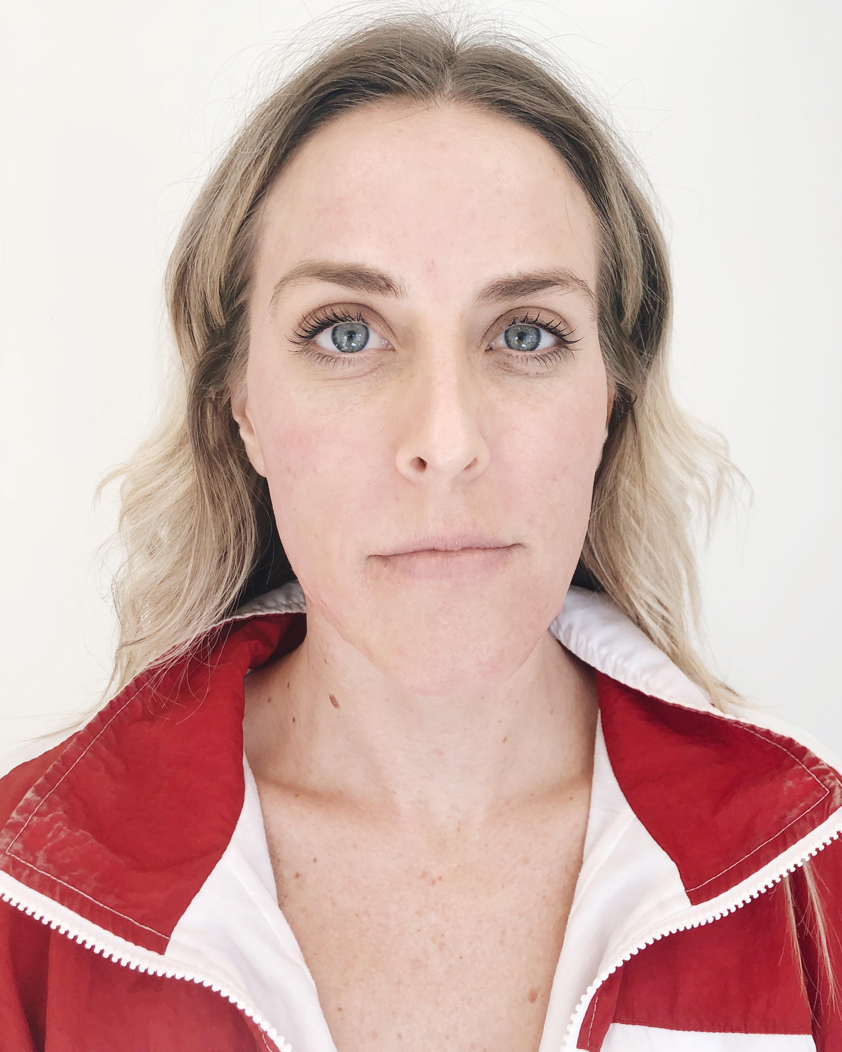 Beth Jones Hydrafacial