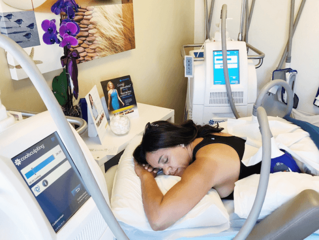 CoolSculpting at Cosmeticare