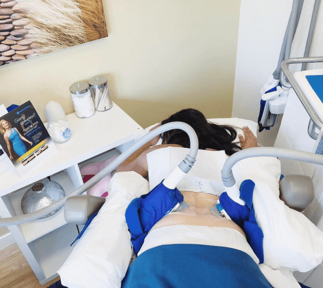 Coolsculpting CycleSave