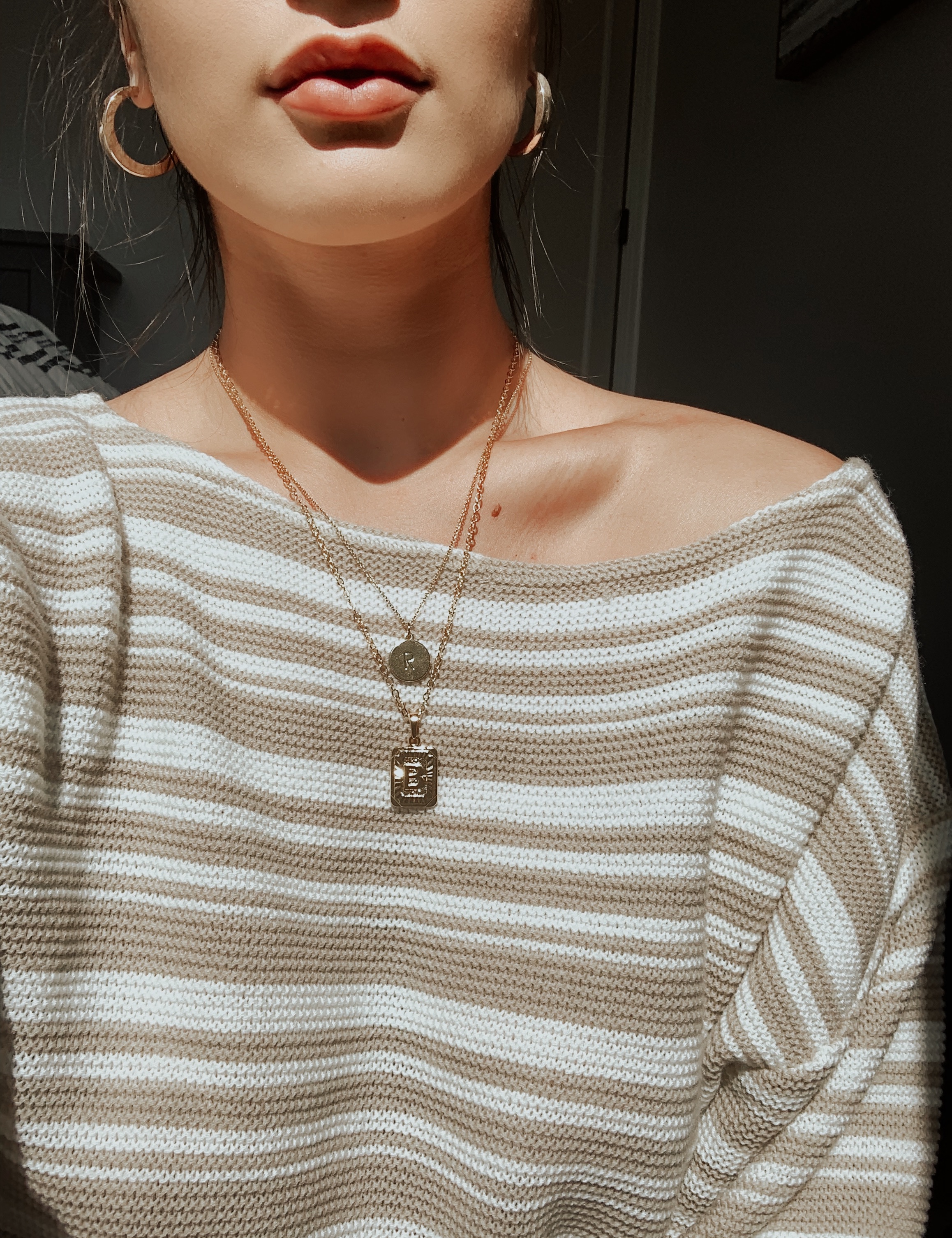 After Lip Filler