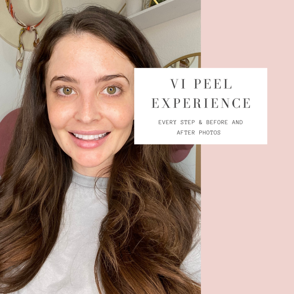 VI Peel Experience with Before and After Photos - CosmetiCare