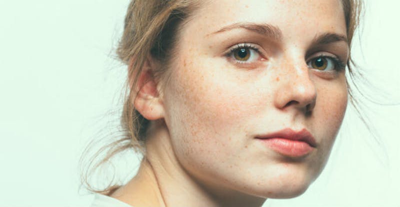 woman with freckles