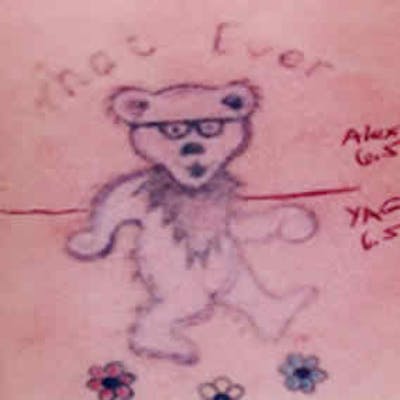 Laser Tattoo Removal Before & After Gallery - Patient 37499761 - Image 1