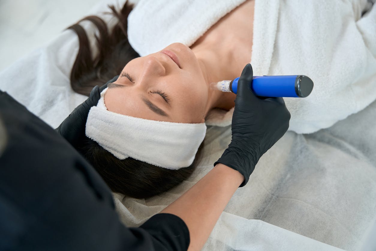 Woman receiving microneedling in Buffalo NY