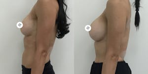 This is one of our beautiful patient 1 patient 1