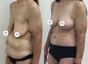 This is one of our beautiful patient 68 patient 68