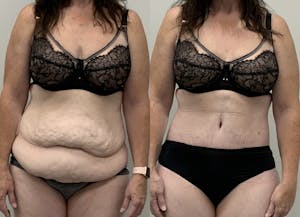 This is one of our beautiful patient 116 patient 116