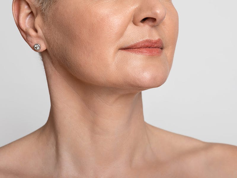 A woman in her 50s after a beautiful neck lift result