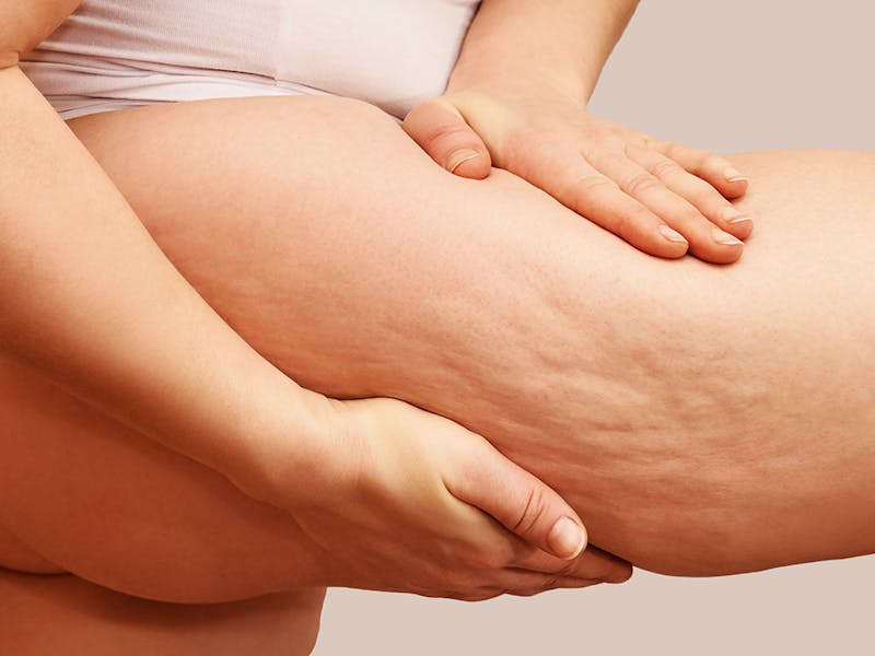 A close-up photo of woman's thighs