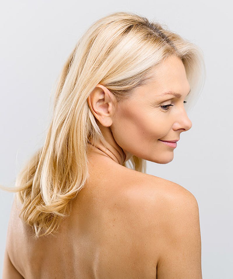 A woman in her 50s looking very rejuvenated after an eyelid surgery