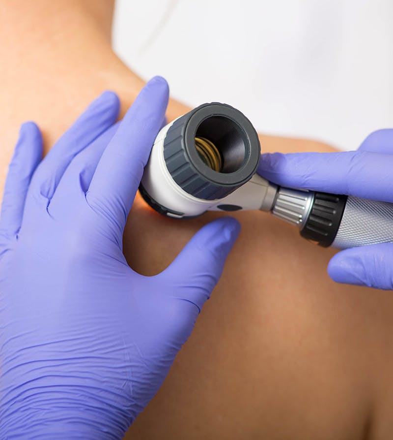 A patient getting her skin lesions examined by a healthcare professional