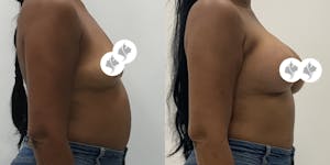 This is one of our beautiful patient 64 patient 64