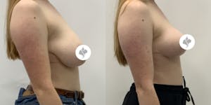 This is one of our beautiful patient 1 patient 1