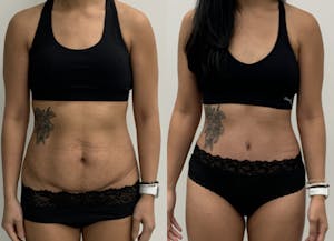 This is one of our beautiful patient 2 patient 2