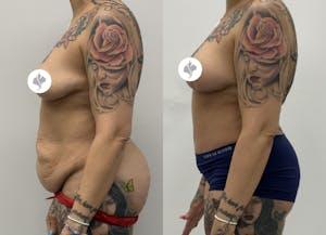 This is one of our beautiful patient 9 patient 9