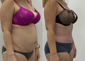 This is one of our beautiful patient 8 patient 8