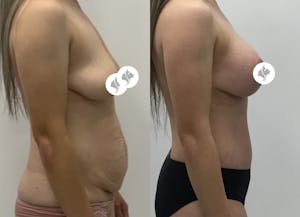 This is one of our beautiful patient 32 patient 32