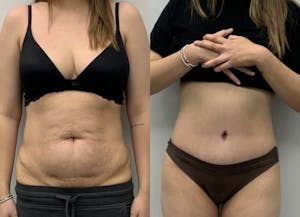This is one of our beautiful patient 7 patient 7