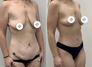This is one of our beautiful patient 3 patient 3