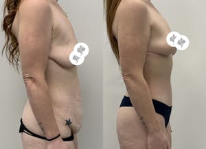 This is one of our beautiful patient 3 patient 3
