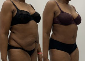 This is one of our beautiful patient 6 patient 6