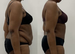 This is one of our beautiful patient 6 patient 6