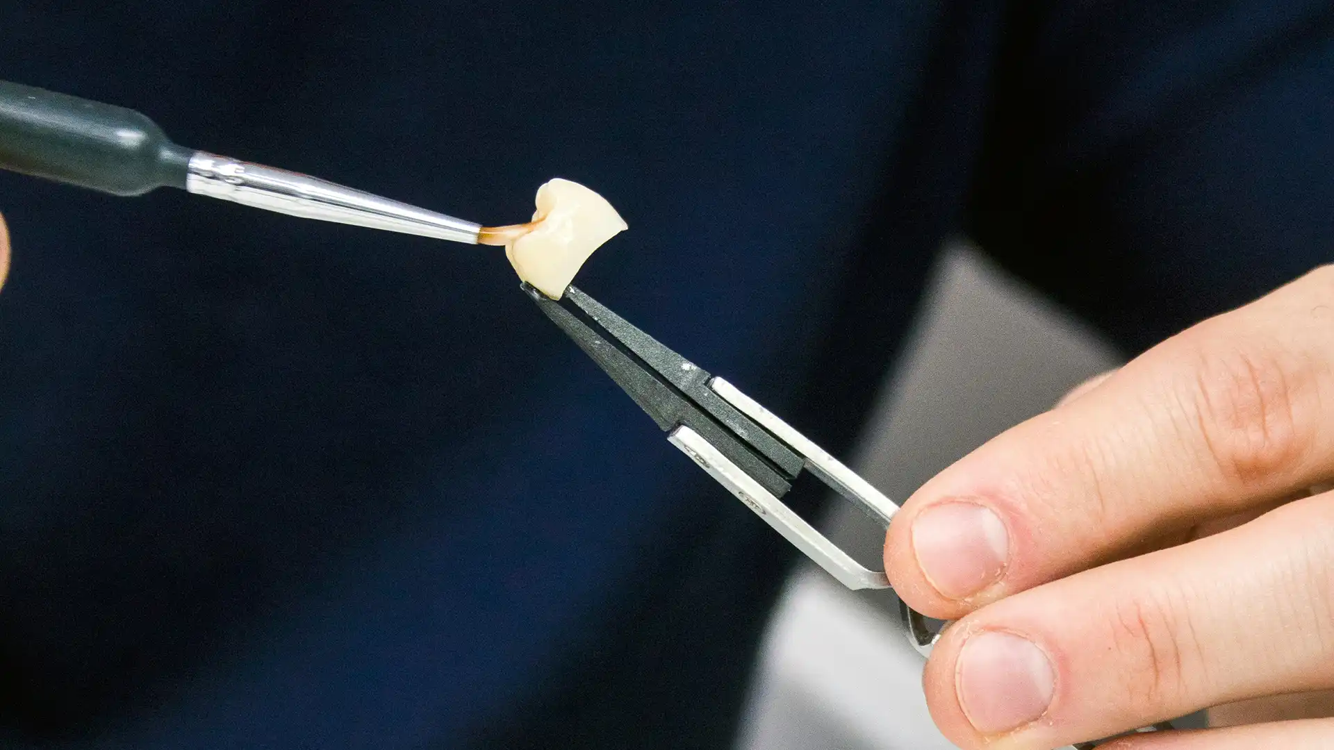 Close-up van hand die werkt aan tandkroon met pincet, geschikt voor kronen vergoeding en verzekering.