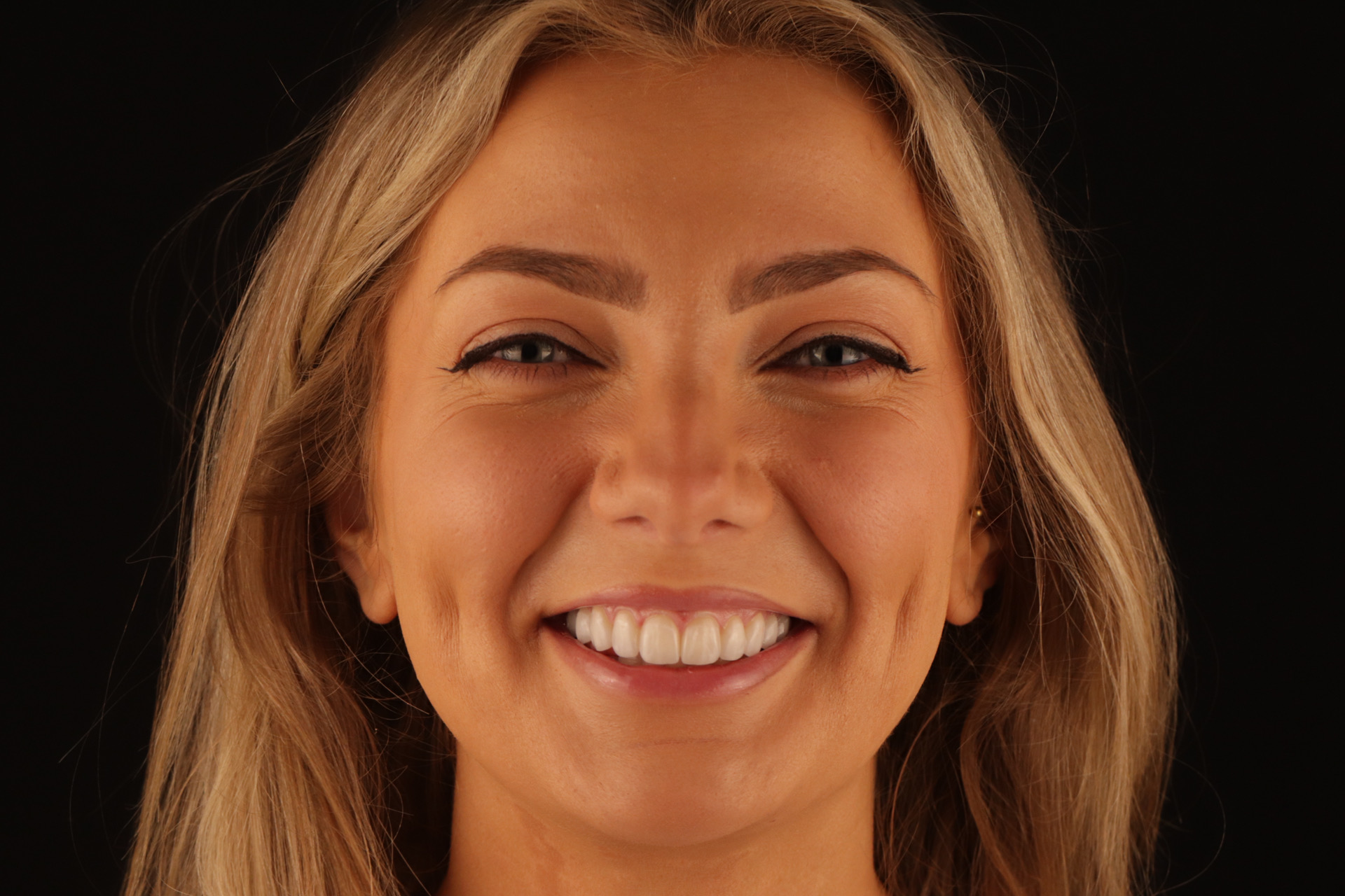 Private Dental Treatments - Lodge Dental, Abergavenny