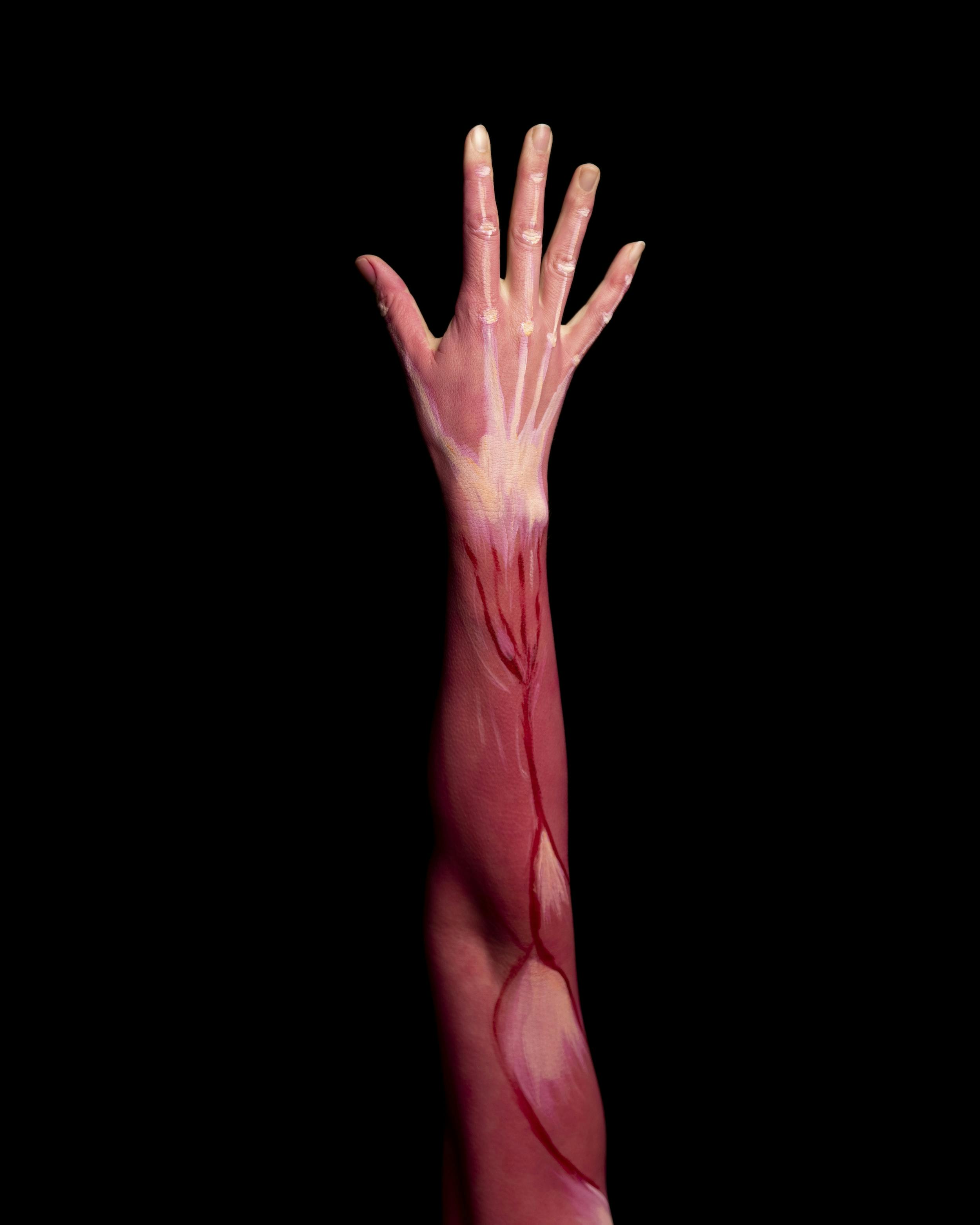 Elongated right arm on black background, with muscle bundles in evidence.