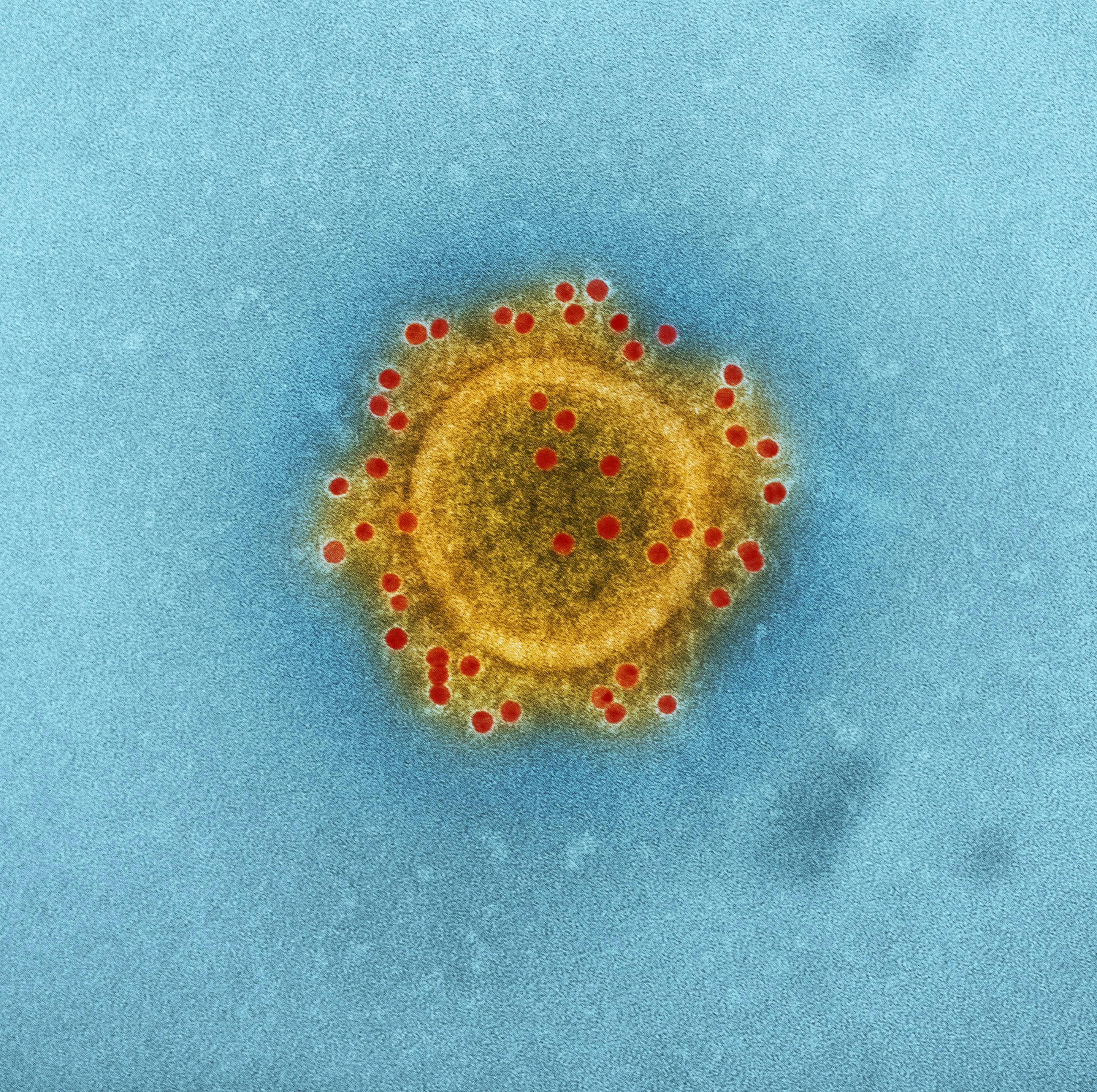 Virus