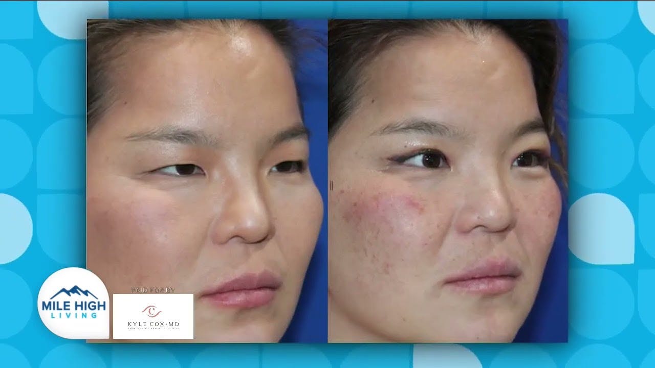 Mile High Living Dr. Kyle Cox interview vid thumbnail