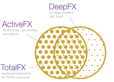 Deep FX / Active FX / Total FX Infographic
