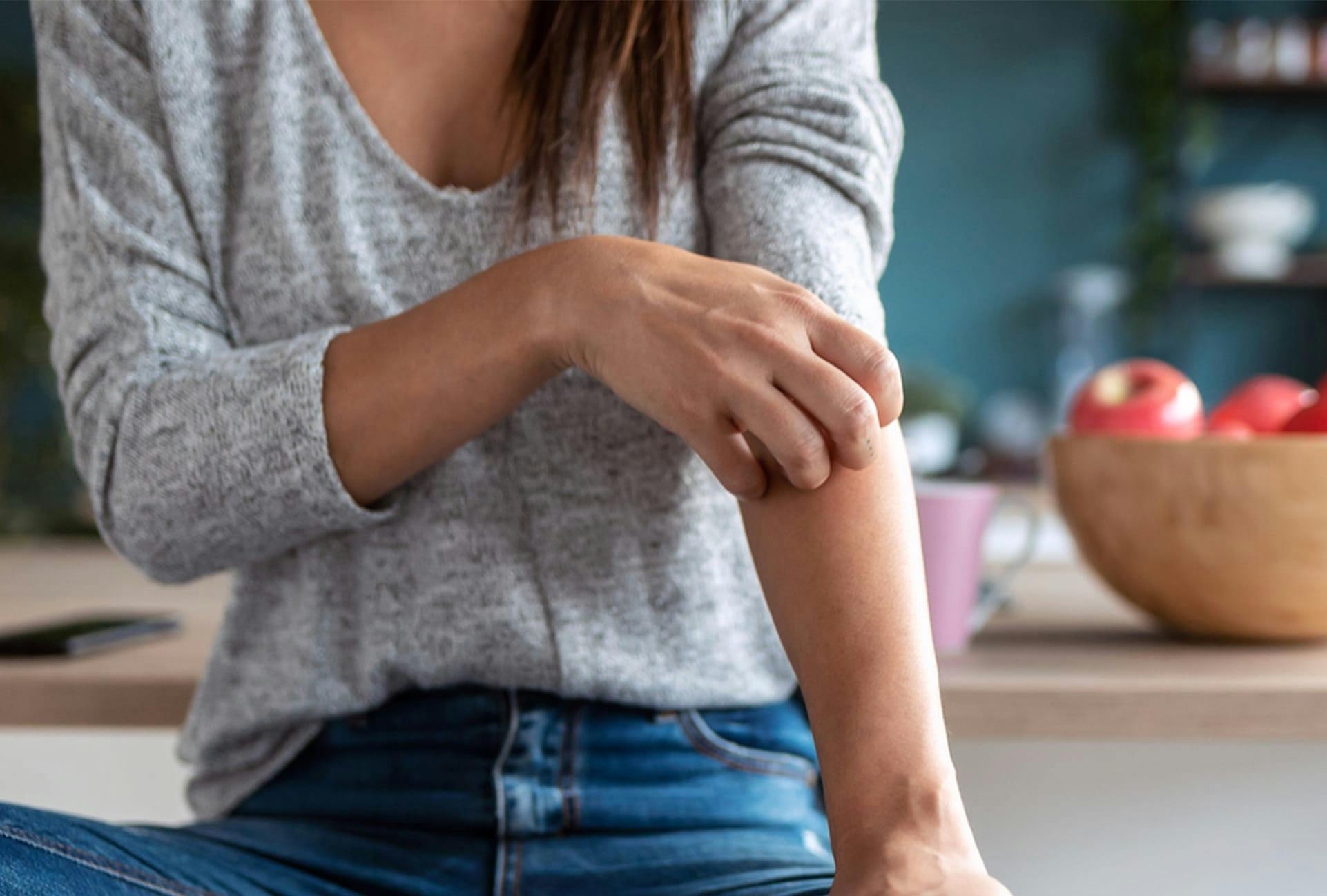 woman itching her arm
