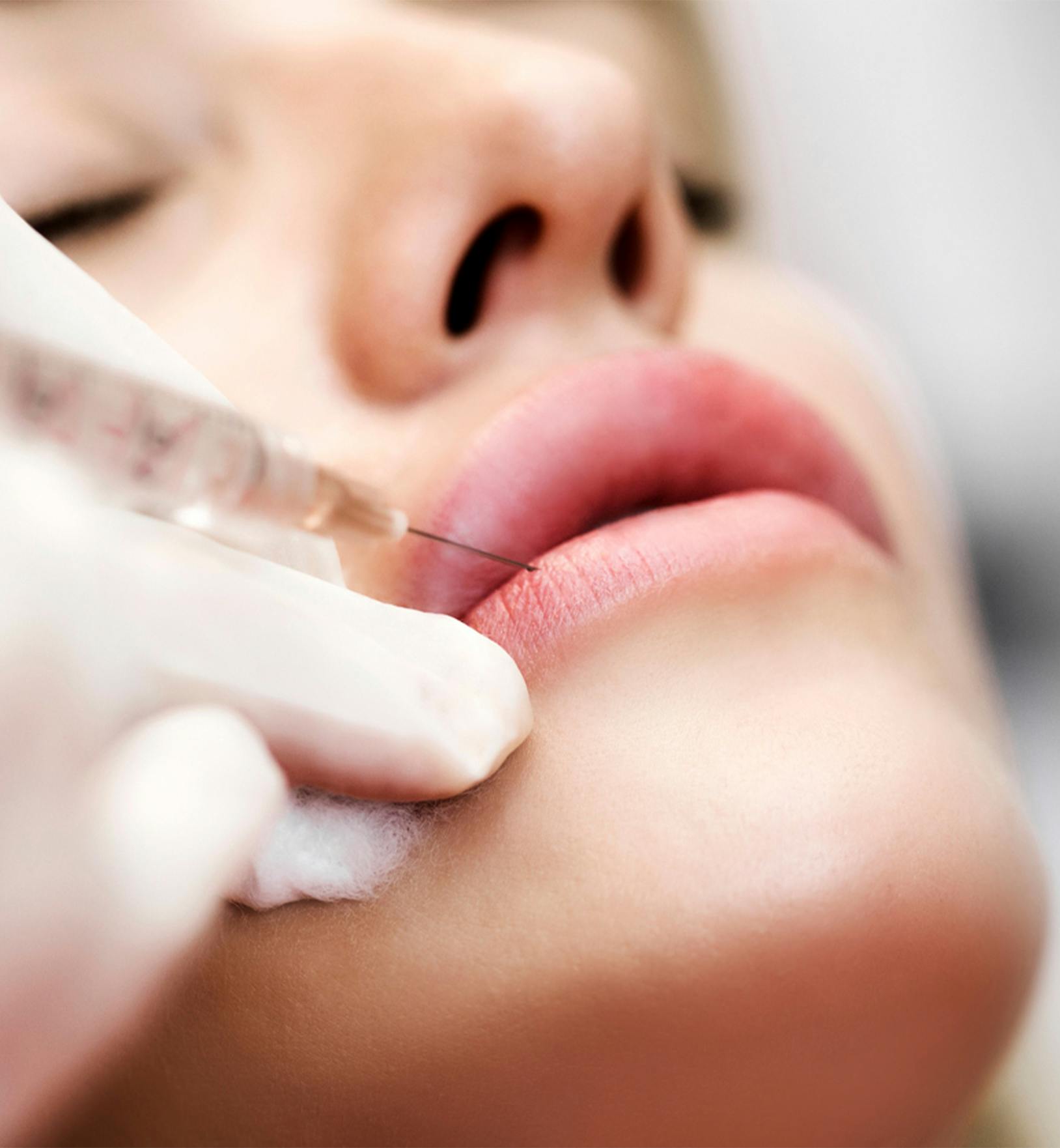 person getting lip fillers