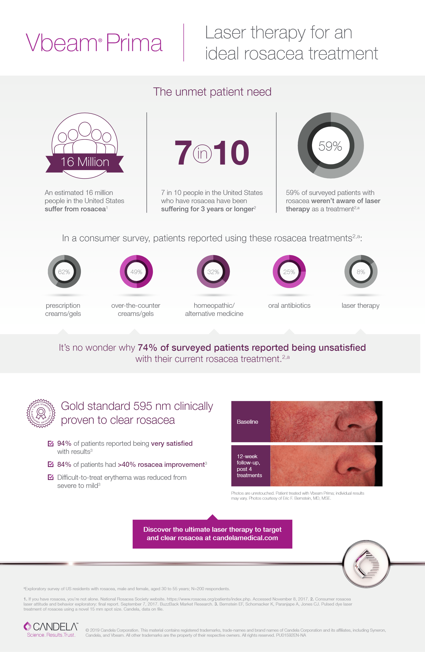 VBeam infographic
