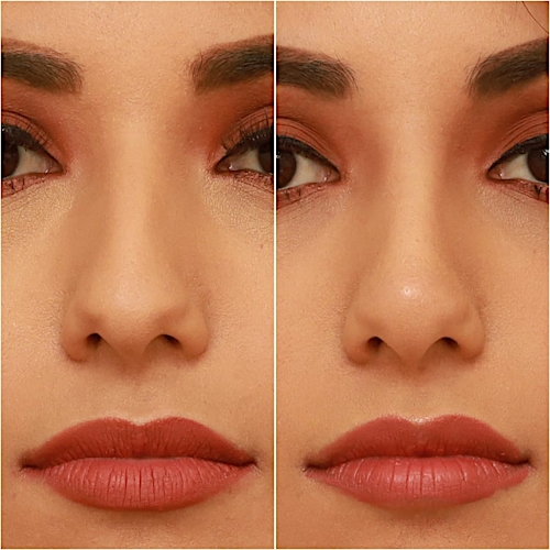 Non-Surgical Rhinoplasty Before & After Gallery - Patient 58233384 - Image 2