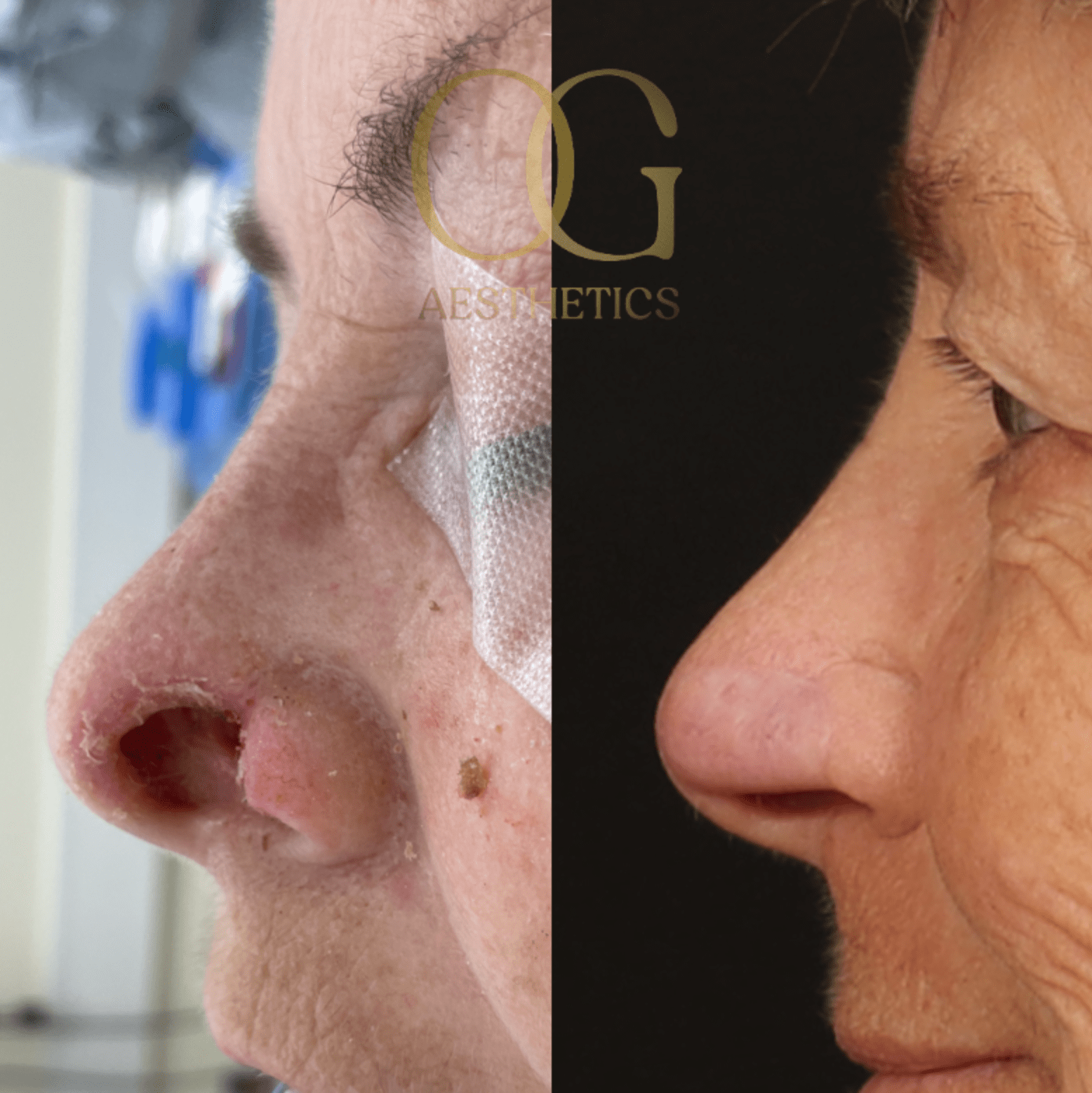 Facial Reconstruction Before & After Gallery - Patient 191975319 - Image 2