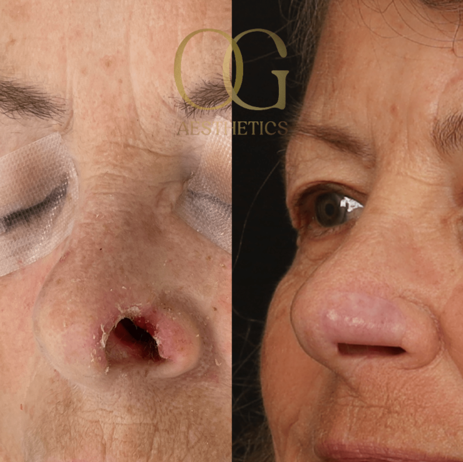 Facial Reconstruction Before & After Gallery - Patient 191975319 - Image 3
