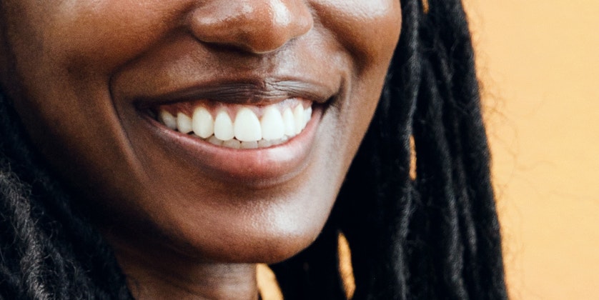 Professional Teeth Whitening
