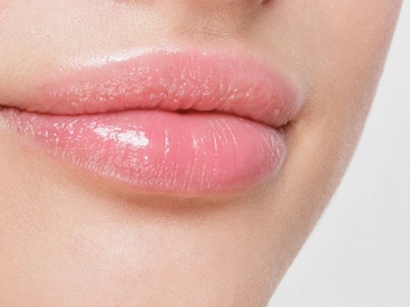 Injectable Fillers